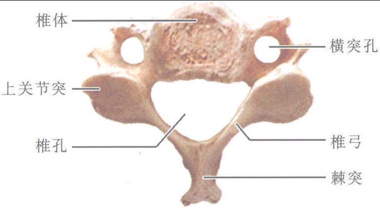 图1-1-6 颈椎(上面)